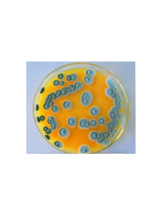 ?，F(xiàn)青霉