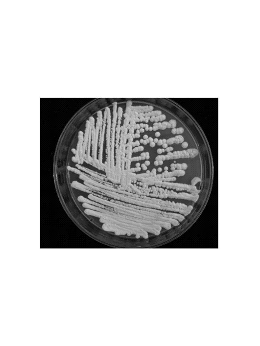 扣囊復(fù)膜孢酵母