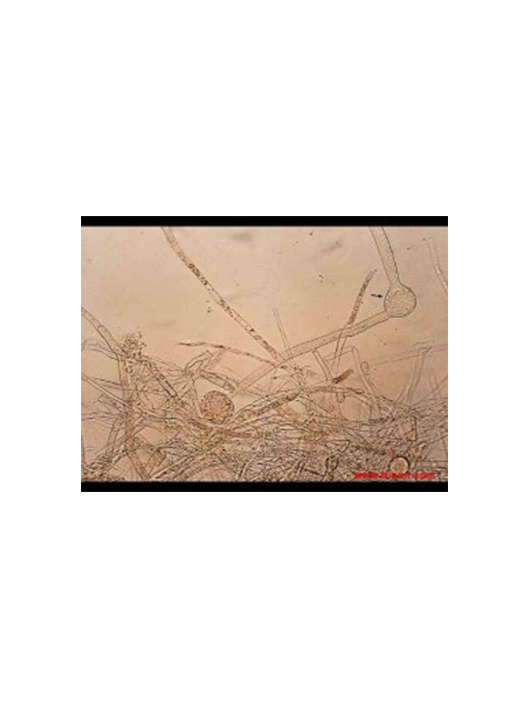 嗜熱側(cè)孢霉