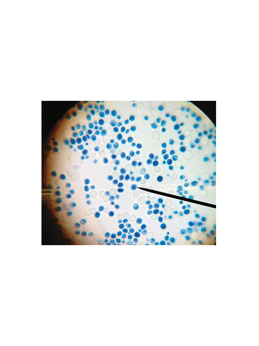 解脂耶羅威亞酵母